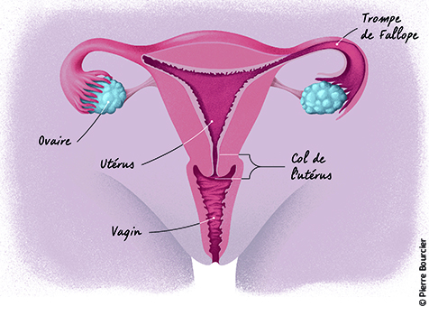 Cancer des Ovaires Symptôme Traitement