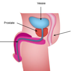 Tisane Prostate