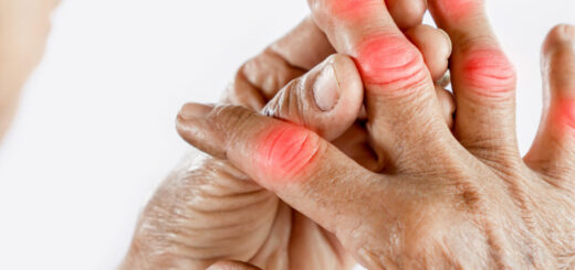 Goutte Causes Traitements